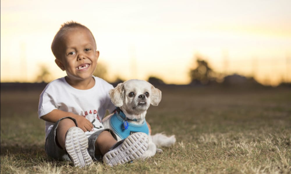 Cane aiuta bimbo ad accettare il suo nanismo