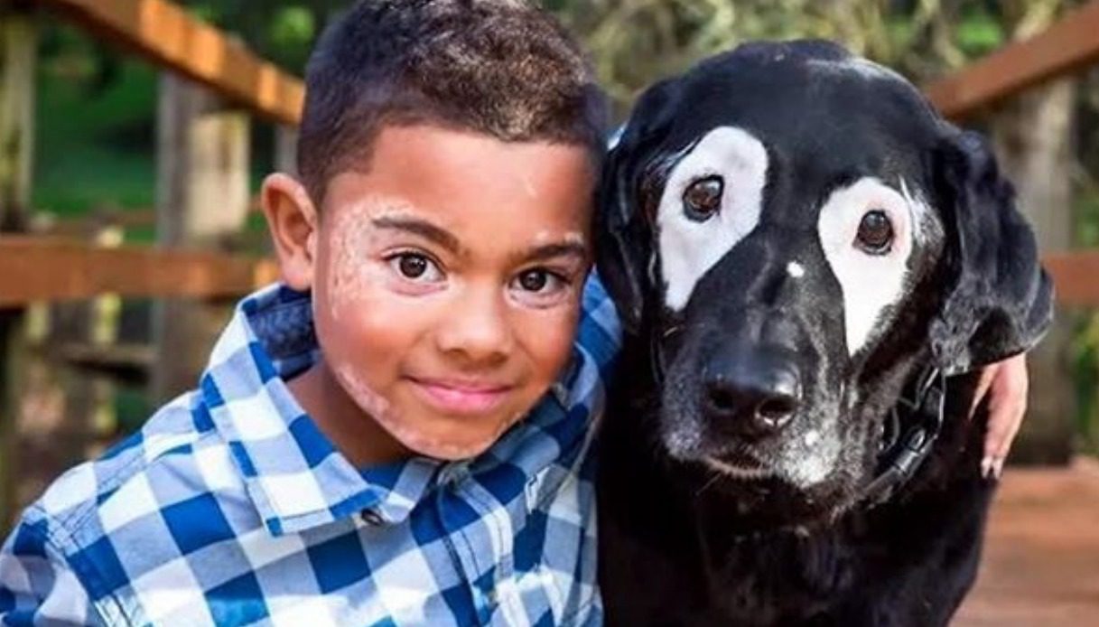 Cane con la vitiligine incontra un bimbo con la sua stessa condizione: è amore a prima vista [VIDEO]